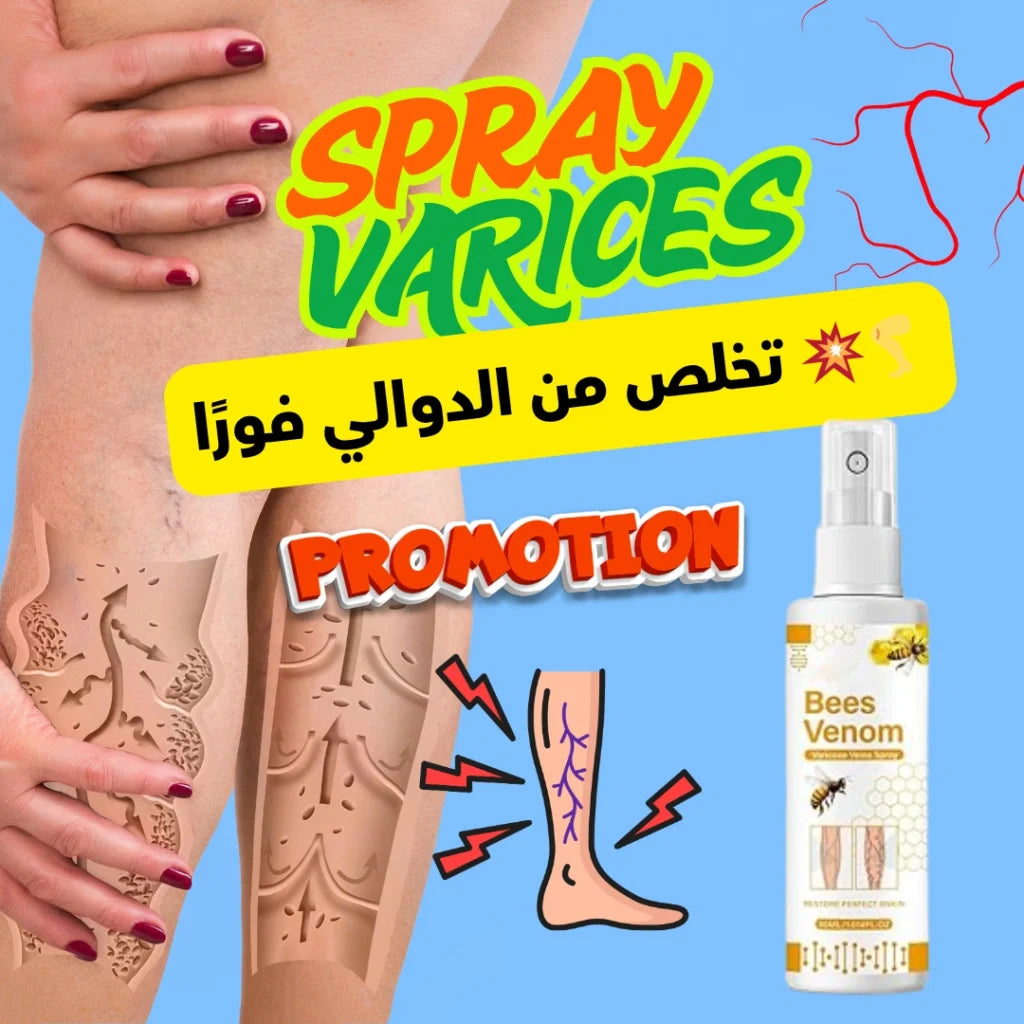 تخلص من الدوالي فورًا